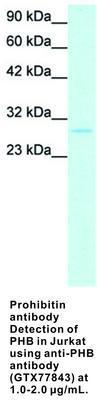 Prohibitin antibody - 50µg, GeneTex