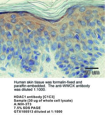 WWOX antibody - 100µg, GeneTex