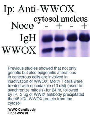 WWOX antibody - 100µg, GeneTex