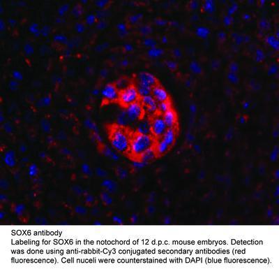 SOX6 antibody, GeneTex