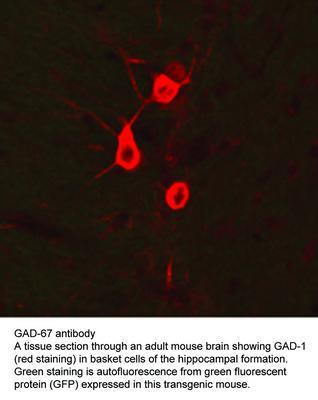 GAD-67 antibody, GeneTex