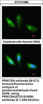 PRKCSH antibody [N1C1], GeneTex