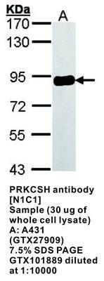 PRKCSH antibody [N1C1], GeneTex