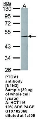 PTOV1 antibody [N1N3], GeneTex