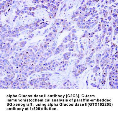 alpha Glucosidase II antibody [C2C3], C-term, GeneTex