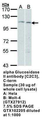 alpha Glucosidase II antibody [C2C3], C-term, GeneTex