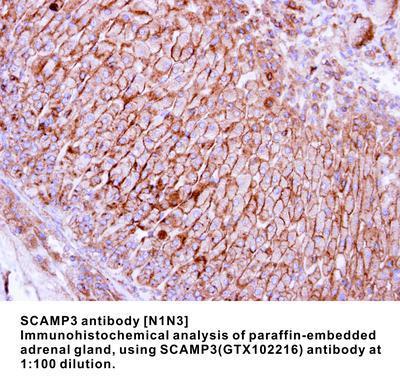 SCAMP3 antibody [N1N3], GeneTex