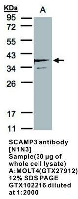 SCAMP3 antibody [N1N3], GeneTex