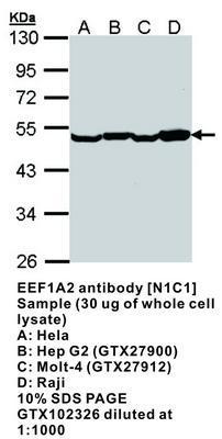 EEF1A2 antibody [N1C1], GeneTex