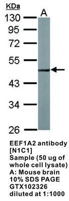 EEF1A2 antibody [N1C1], GeneTex