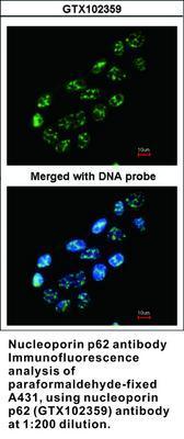 nucleoporin p62  antibody [C1C3], GeneTex