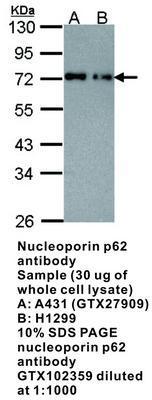 nucleoporin p62  antibody [C1C3], GeneTex