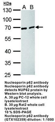 nucleoporin p62  antibody [C1C3], GeneTex