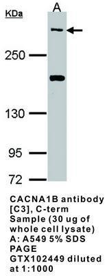 CACNA1B antibody [C3], C-term, GeneTex