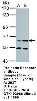 Prolactin Receptor antibody, GeneTex