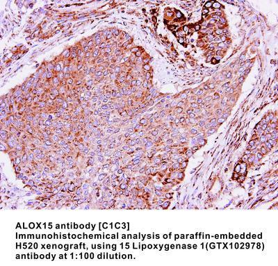 ALOX15 antibody [C1C3], GeneTex