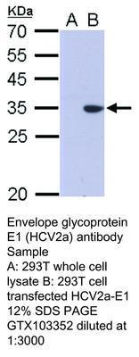 Envelope glycoprotein E1 (HCV2a) antibody, GeneTex