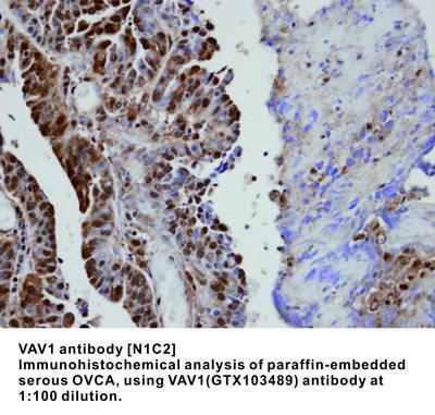 VAV1 antibody [N1C2], GeneTex