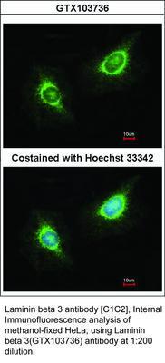 Laminin beta 3 antibody [C1C2], Internal, GeneTex