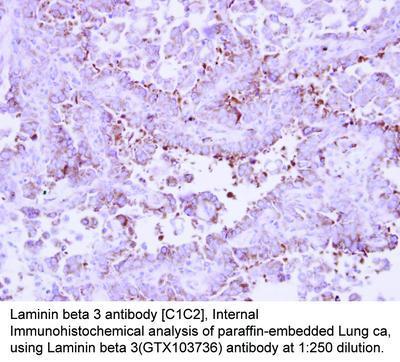 Laminin beta 3 antibody [C1C2], Internal, GeneTex