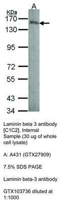 Laminin beta 3 antibody [C1C2], Internal, GeneTex