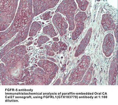 FGFR-5  antibody, GeneTex