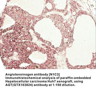 Angiotensinogen antibody [N1C3], GeneTex