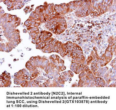 Dishevelled 2 antibody [N2C2], Internal, GeneTex