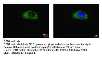 GPD1 antibody [N1C3], GeneTex