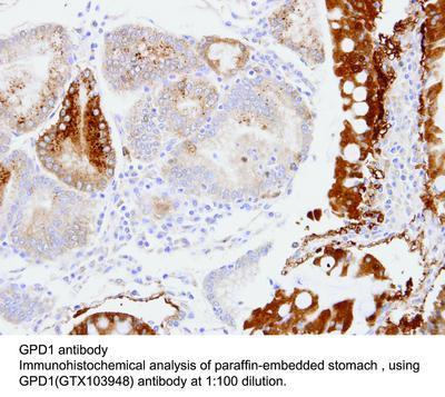 GPD1 antibody [N1C3], GeneTex