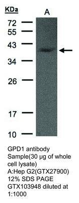 GPD1 antibody [N1C3], GeneTex