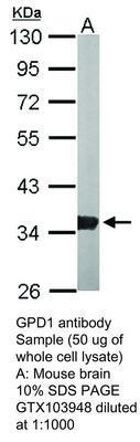 GPD1 antibody [N1C3], GeneTex