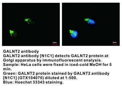 GALNT2 antibody [N1C1], GeneTex