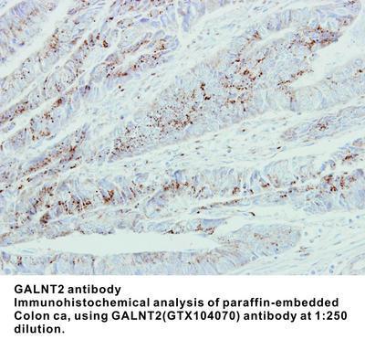 GALNT2 antibody [N1C1], GeneTex