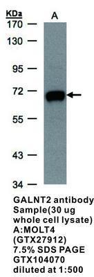 GALNT2 antibody [N1C1], GeneTex