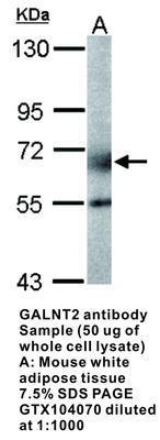 GALNT2 antibody [N1C1], GeneTex