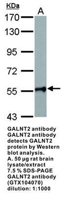 GALNT2 antibody [N1C1], GeneTex