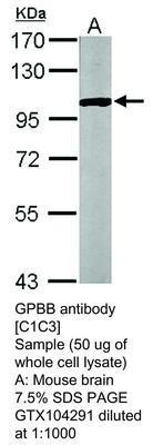 GPBB antibody [C1C3], GeneTex