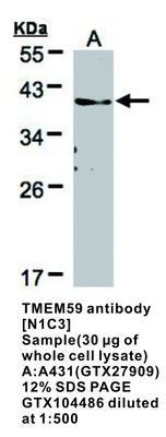 TMEM59 antibody [N1C3], GeneTex