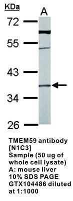 TMEM59 antibody [N1C3], GeneTex