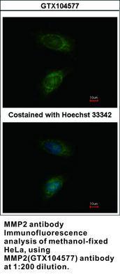 MMP2 antibody - 100µl, GeneTex