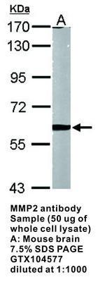 MMP2 antibody - 100µl, GeneTex