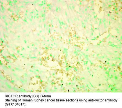 RICTOR antibody [C3], C-term, GeneTex