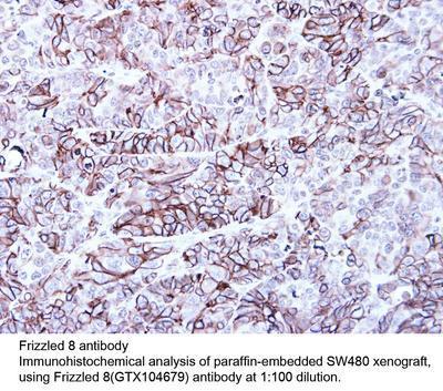 Frizzled 8 antibody, GeneTex