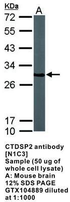 CTDSP2 antibody [N1C3], GeneTex