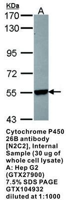 Cytochrome P450 26B  antibody [N2C2], Internal, GeneTex