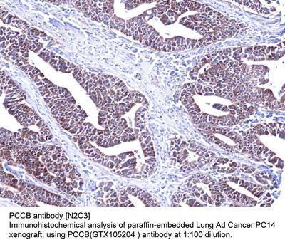 PCCB antibody [N2C3], GeneTex