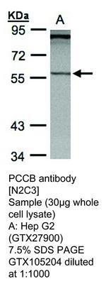 PCCB antibody [N2C3], GeneTex