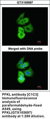 PFKL antibody [C1C3], GeneTex