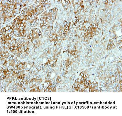 PFKL antibody [C1C3], GeneTex